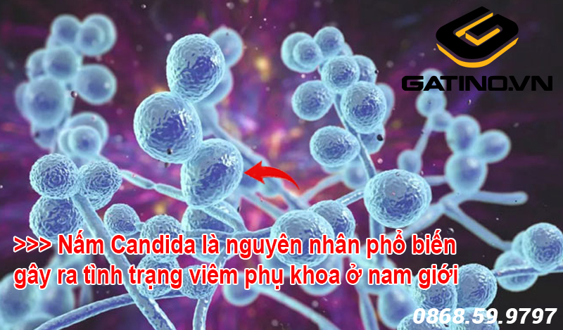 Nấm Candida là vi khuẩn gây nên các bệnh phụ khoa phổ biến ở nam giới