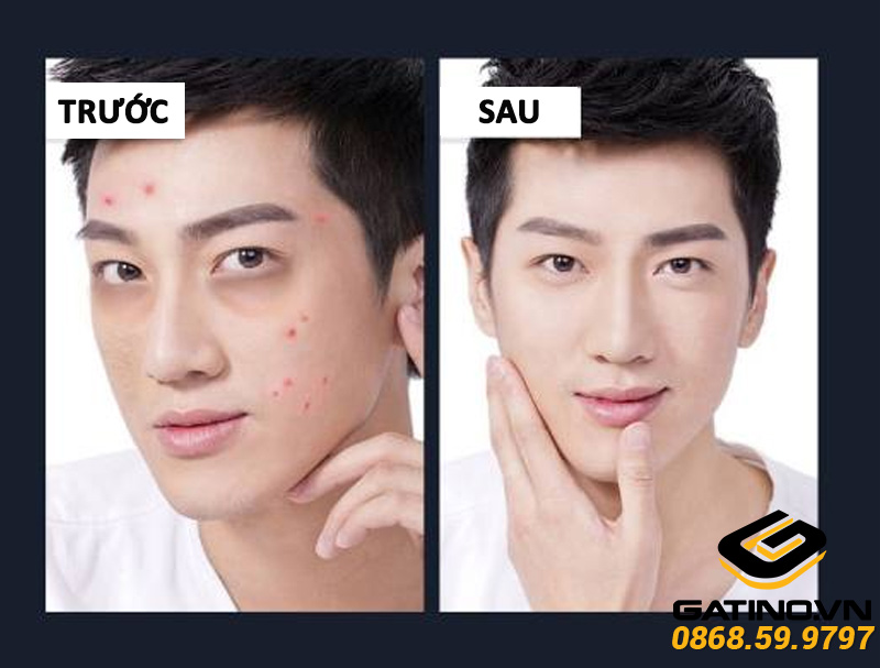 cong-dung-cua-kem-Concealer