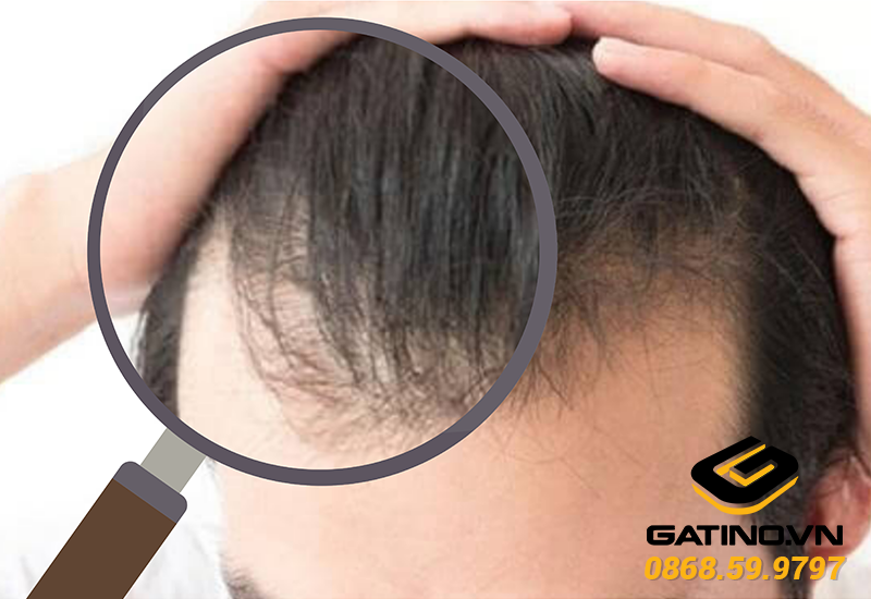 Tóc mảnh là gì